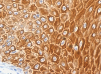 KRT16 Antibody / Cytokeratin 16