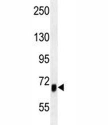 ACVR1B Antibody / Activin receptor type-1B / ALK4, 0.08ml