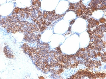 IHC: Formalin-fixed, paraffin-embedded human parathyroid stained with Parathyroid Hormone antibody (