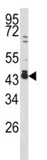 c-Fos Antibody