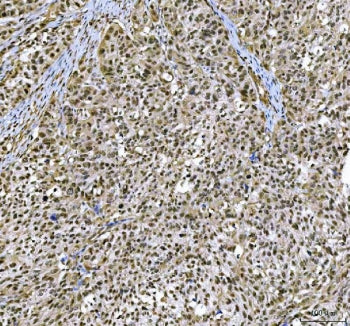 NCBP2 Antibody / Nuclear cap-binding protein subunit 2 / CBP20