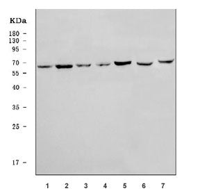 PRKAG2 Antibody / AMPK gamma 2