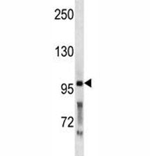 PCSK5 Antibody