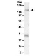 MAP3K6 Antibody
