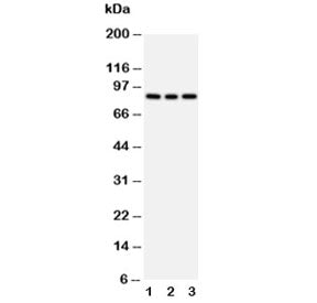 Western blot testing of PI3K antibody and Lane 1: rat testis; 2: 293T; 3: HeLa cell lysate. Predicte