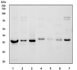 Western blot testing of 1) human K562, 2) human HeLa, 3) human Jurkat, 4) rat brain, 5) rat spleen,