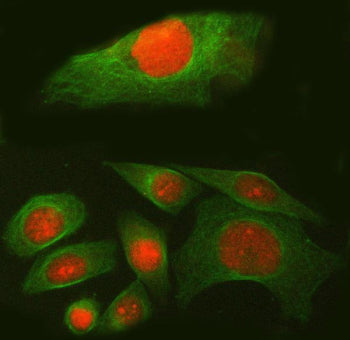 Immunofluorescent staining of FFPE human SiHa cells with SPAG7 antibody (red) and Alpha Tubulin mAb