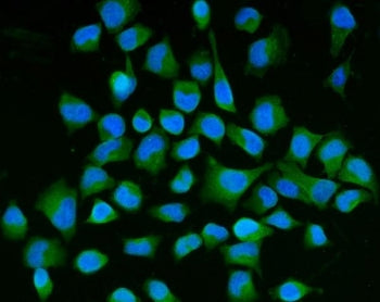 Semaphorin 3B Antibody / SEMA3B