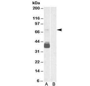 P2RX7 Antibody
