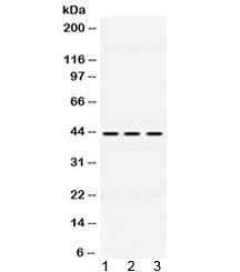 Western blot testing of 1) rat liver, 2) mouse spleen and 3) human HepG2 lysate with DHODH antibody