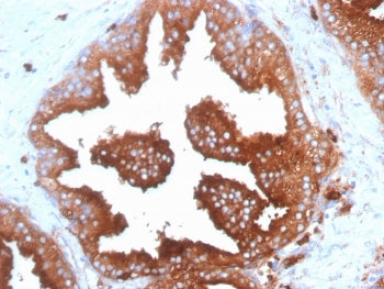 IHC: Formalin-fixed, paraffin-embedded human prostate tissue stained with anti-CD63 antibody (clone