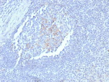 IHC staining of FFPE human tonsil tissue with CD23 antibody (clone FCER2/8235R). HIER: boil tissue s