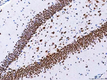 IHC staining of FFPE rat hippocampus tissue with CBP80 antibody. HIER: boil tissue sections in pH8 E