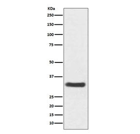 NQO1 Antibody