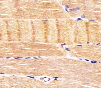 CDK5 Antibody