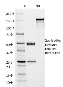 HSV1 Antibody / Herpes Simplex Virus Type I