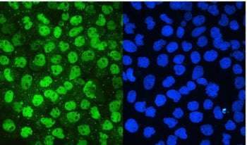 MCM2 Antibody