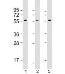 AKT2 Antibody