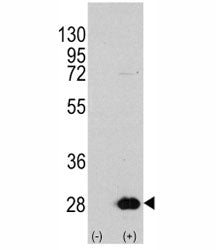 HSP27 Antibody (HSPB1)