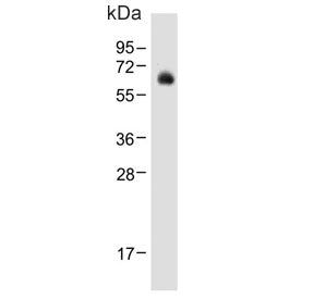 UDP-glucuronosyltransferase 2B15 Antibody / UGT2B15