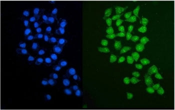 PARP2 Antibody