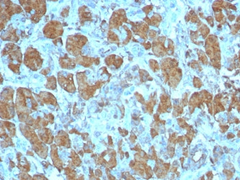 IHC staining of FFPE human pancreas tissue with CPA1 antibody (clone CPA1/8259R). HIER: boil tissue
