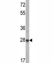 IGFBP6 Antibody