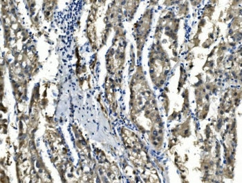 Sorbitol Dehydrogenase Antibody
