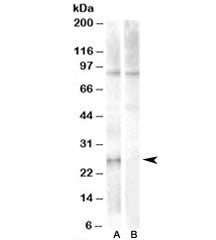 APOBEC2 Antibody