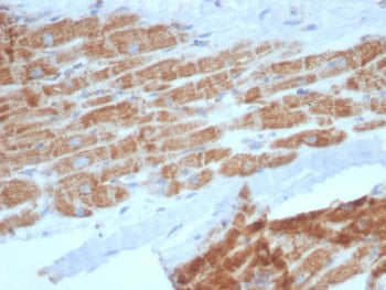 SDHA Antibody