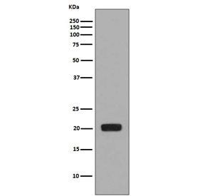 Macrophage Colony Stimulating Factor 1 Antibody / CSF1