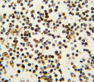 NPM1 Antibody