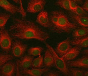 Immunofluorescent staining of FFPE human HeLa cells with ING2 antibody (green) and Beta Tubulin mAb
