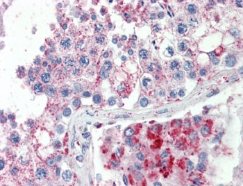 SPAG16 Antibody
