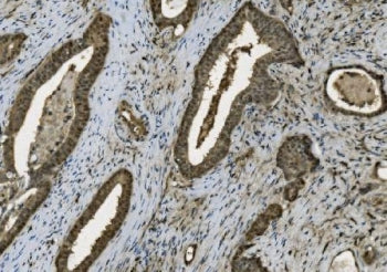 PARP1 Antibody