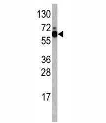 S6K Antibody