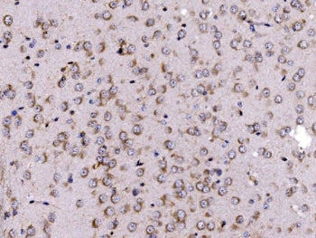 IHC staining of FFPE rat brain tissue with FKBP15 antibody. HIER: boil tissue sections in pH8 EDTA f