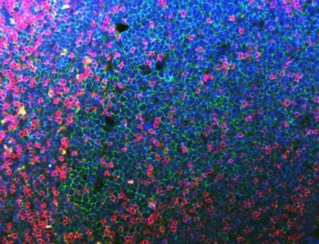 Immunofluorescent staining of FFPE human tonsil tissue with CD20 antibody (green), CD3e antibody (re