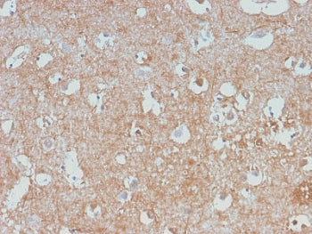Neurofilament Antibody (-Light) / NF-L / NEFL
