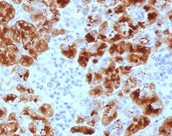 Glycoprotein 2 Antibody / GP2 / ZAP75