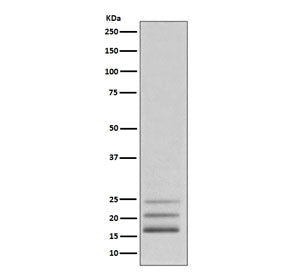 Western blot testing of human K562 cell lysate with FGF2 antibody. Predicted molecular weight: 17-31