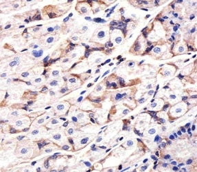 Epidermal growth factor receptor Antibody (EGFR)