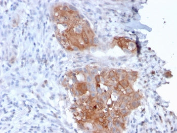 Desmoglein 1 Antibody / DSG1