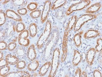 Integrin beta 3 Antibody / ITGB3 / CD61