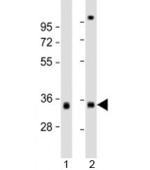 TPM3 Antibody / Tropomyosin-3