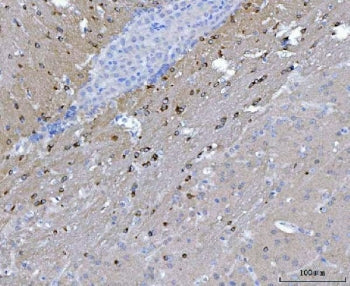 IHC staining of FFPE mouse brain tissue with NOS1AP antibody. HIER: boil tissue sections in pH8 EDTA