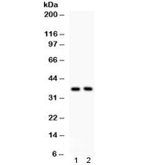 Western blot testing of human 1) PANC and 2) U87 cell lysate with FRZB antibody. Expected/observed m