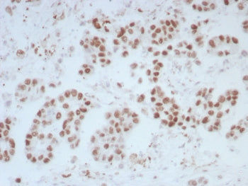 IHC staining of FFPE human bladder tissue with ERCC1 antibody (clone ERCC1/7597). HIER: boil tissue