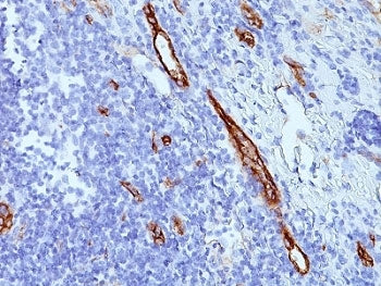 von Willebrand Factor Antibody / vWF