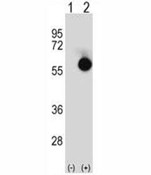 Western blot analysis of CTBP2 antibody and 293 cell lysate either nontransfected (Lane 1) or transi